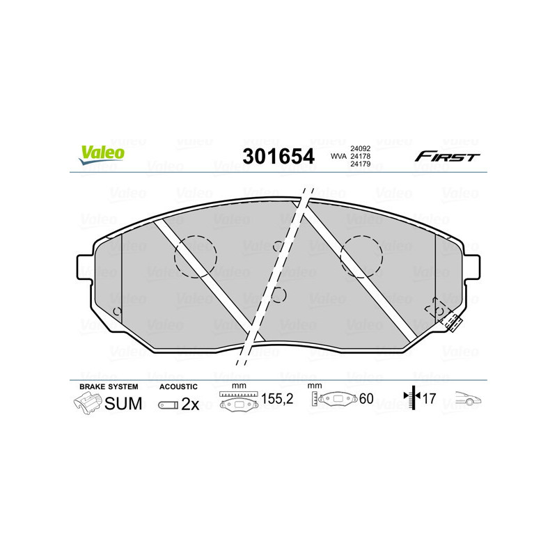 VALEO 301654 Pastiglie freno Anteriore per